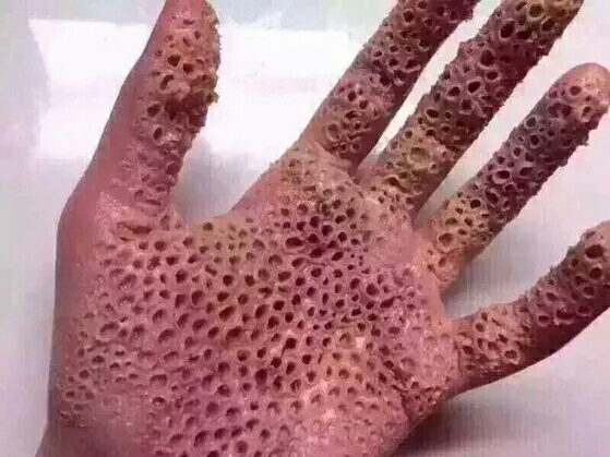 芝麻女孩和玉米男孩的照片